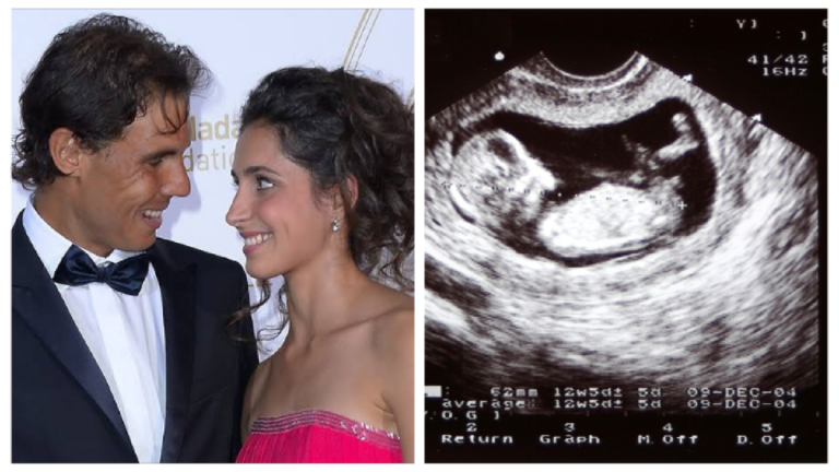 Rafael Nadal’s pregnant wife Mery Perello displays her bump