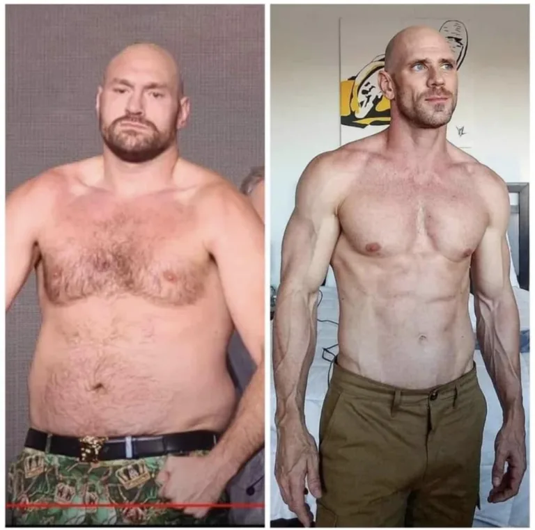 Tyson Fury’s Transformation Over the Years