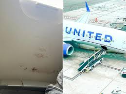 Blood found on wall of airplane; United Airlines flight attendant does nothing